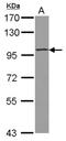ST18 C2H2C-Type Zinc Finger Transcription Factor antibody, NBP2-20490, Novus Biologicals, Western Blot image 