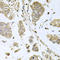 SBDS Ribosome Maturation Factor antibody, LS-C334358, Lifespan Biosciences, Immunohistochemistry paraffin image 