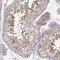 Endoplasmic reticulum-Golgi intermediate compartment protein 2 antibody, HPA049695, Atlas Antibodies, Immunohistochemistry frozen image 