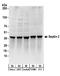 Septin-2 antibody, A304-210A, Bethyl Labs, Western Blot image 