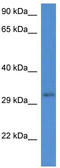 UBX Domain Protein 2A antibody, TA337589, Origene, Western Blot image 