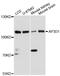 Adaptor Related Protein Complex 3 Subunit Delta 1 antibody, A07250-1, Boster Biological Technology, Western Blot image 