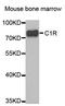 Complement C1r subcomponent antibody, orb213623, Biorbyt, Western Blot image 