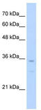 NK3 Homeobox 2 antibody, TA341748, Origene, Western Blot image 