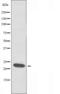 Ribosomal Protein L18 antibody, orb226225, Biorbyt, Western Blot image 