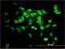 Small Glutamine Rich Tetratricopeptide Repeat Containing Alpha antibody, H00006449-M06, Novus Biologicals, Immunocytochemistry image 