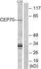 Centrosomal protein of 70 kDa antibody, LS-C119835, Lifespan Biosciences, Western Blot image 