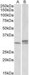 Homeobox A9 antibody, EB10046, Everest Biotech, Western Blot image 