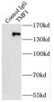 TATA Element Modulatory Factor 1 antibody, FNab08796, FineTest, Immunoprecipitation image 