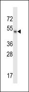Male-specific lethal 1 homolog antibody, PA5-48690, Invitrogen Antibodies, Western Blot image 