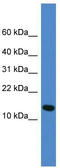 Ubiquitin Fold Modifier 1 antibody, TA342603, Origene, Western Blot image 