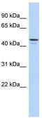 Ectonucleotide Pyrophosphatase/Phosphodiesterase 6 antibody, TA337843, Origene, Western Blot image 