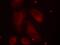 LIM Domain Kinase 1 antibody, PA5-37629, Invitrogen Antibodies, Immunofluorescence image 