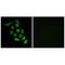 Ribosomal Protein S12 antibody, A01040, Boster Biological Technology, Immunohistochemistry paraffin image 
