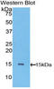Vascular Endothelial Growth Factor C antibody, LS-C305078, Lifespan Biosciences, Western Blot image 