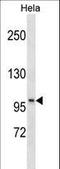 Protein phosphatase Slingshot homolog 1 antibody, LS-C156139, Lifespan Biosciences, Western Blot image 