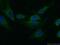 Poly(A) Specific Ribonuclease Subunit PAN2 antibody, 16427-1-AP, Proteintech Group, Immunofluorescence image 