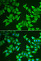 5'-Aminolevulinate Synthase 2 antibody, 22-284, ProSci, Immunofluorescence image 