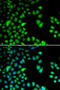 Ribosomal Protein S6 Kinase A3 antibody, 19-659, ProSci, Immunofluorescence image 