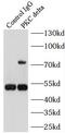 Protein kinase C delta type antibody, FNab06483, FineTest, Immunoprecipitation image 