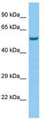 5-Hydroxytryptamine Receptor 3E antibody, TA337723, Origene, Western Blot image 