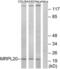 Mitochondrial Ribosomal Protein L20 antibody, LS-B9683, Lifespan Biosciences, Western Blot image 