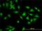 Cytohesin 2 antibody, H00009266-M02, Novus Biologicals, Immunocytochemistry image 