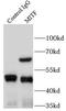 Melanocyte Inducing Transcription Factor antibody, FNab05198, FineTest, Immunoprecipitation image 