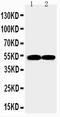 Fli-1 Proto-Oncogene, ETS Transcription Factor antibody, PA2179, Boster Biological Technology, Western Blot image 