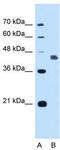 Gasdermin E antibody, TA339270, Origene, Western Blot image 
