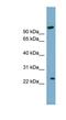 ADP Ribosylation Factor Like GTPase 8B antibody, NBP1-56544, Novus Biologicals, Western Blot image 