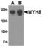 Myosin Heavy Chain 8 antibody, MBS153376, MyBioSource, Western Blot image 