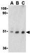 Tetratricopeptide Repeat Domain 5 antibody, GTX85519, GeneTex, Western Blot image 