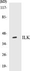 Integrin Linked Kinase antibody, EKC1301, Boster Biological Technology, Western Blot image 