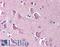 Neuronal PAS Domain Protein 3 antibody, LS-B534, Lifespan Biosciences, Immunohistochemistry paraffin image 