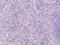 Neutrophil Cytosolic Factor 1 antibody, 203379-T08, Sino Biological, Immunohistochemistry paraffin image 