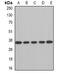 AU RNA Binding Methylglutaconyl-CoA Hydratase antibody, orb341296, Biorbyt, Western Blot image 