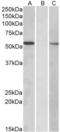 Mannosyl (Alpha-1,3-)-Glycoprotein Beta-1,2-N-Acetylglucosaminyltransferase antibody, NBP1-52077, Novus Biologicals, Western Blot image 