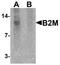 B2M antibody, TA319617, Origene, Western Blot image 