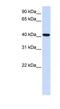 Acyl-CoA Wax Alcohol Acyltransferase 2 antibody, NBP1-91574, Novus Biologicals, Western Blot image 