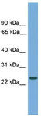 Chromosome 19 Open Reading Frame 18 antibody, TA338862, Origene, Western Blot image 
