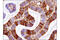 Fascin Actin-Bundling Protein 1 antibody, 99978S, Cell Signaling Technology, Immunohistochemistry paraffin image 