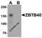 Zinc Finger And BTB Domain Containing 40 antibody, 6905, ProSci, Western Blot image 