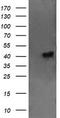 Ciliogenesis Associated TTC17 Interacting Protein antibody, CF505498, Origene, Western Blot image 