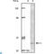 BLK Proto-Oncogene, Src Family Tyrosine Kinase antibody, LS-C812404, Lifespan Biosciences, Western Blot image 