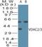 Voltage Dependent Anion Channel 2 antibody, PA1-41205, Invitrogen Antibodies, Western Blot image 