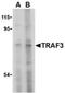 Tumor Necrosis Factor Receptor Associated Factor 3 antibody, NBP1-76642, Novus Biologicals, Western Blot image 