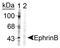 EPH Receptor B1 antibody, NB300-275, Novus Biologicals, Western Blot image 