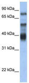 Zinc finger protein 395 antibody, TA331850, Origene, Western Blot image 