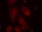 LIM Domain Kinase 1 antibody, NB100-82021, Novus Biologicals, Immunocytochemistry image 